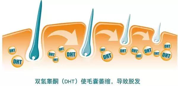 防脱的几种情况,防脱问题图