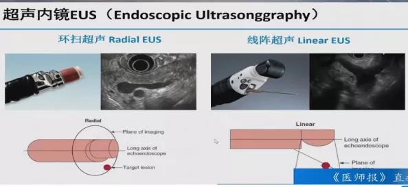 上消化道内镜检查常规流程图谱,消化内镜检查流程及注意事项