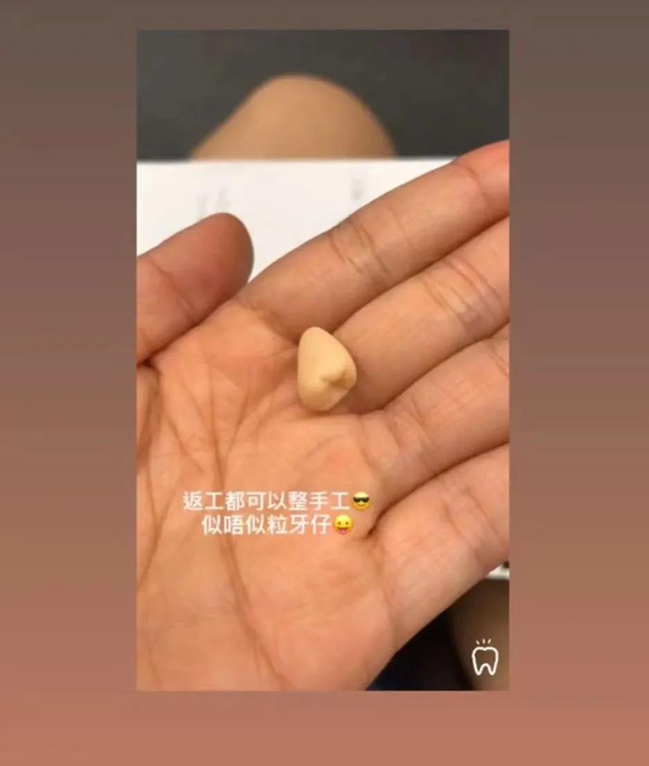 香港牙医收费价格表,香港牙医和内地牙医的区别