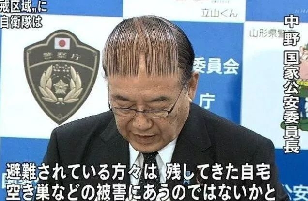 90后“未富先秃”！该拿什么拯救我的发际线？