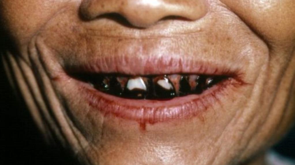 槟榔这么大危害为何不禁售,国家对槟榔政策