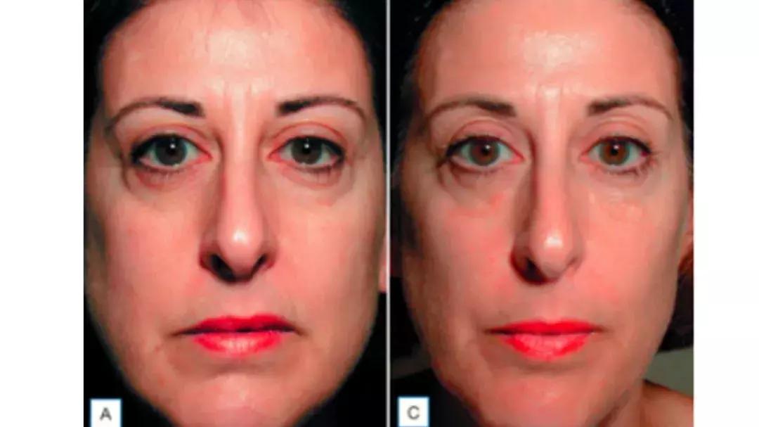 用简单的方法让脸变得更美,简单4个动作随时随地做让脸紧致