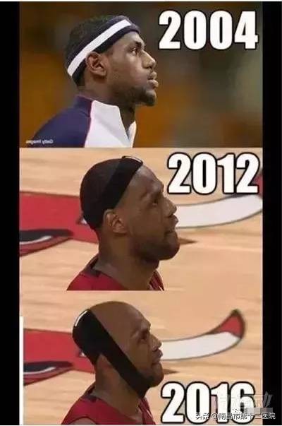 运动会导致脱发白发吗,减肥会脱发吗