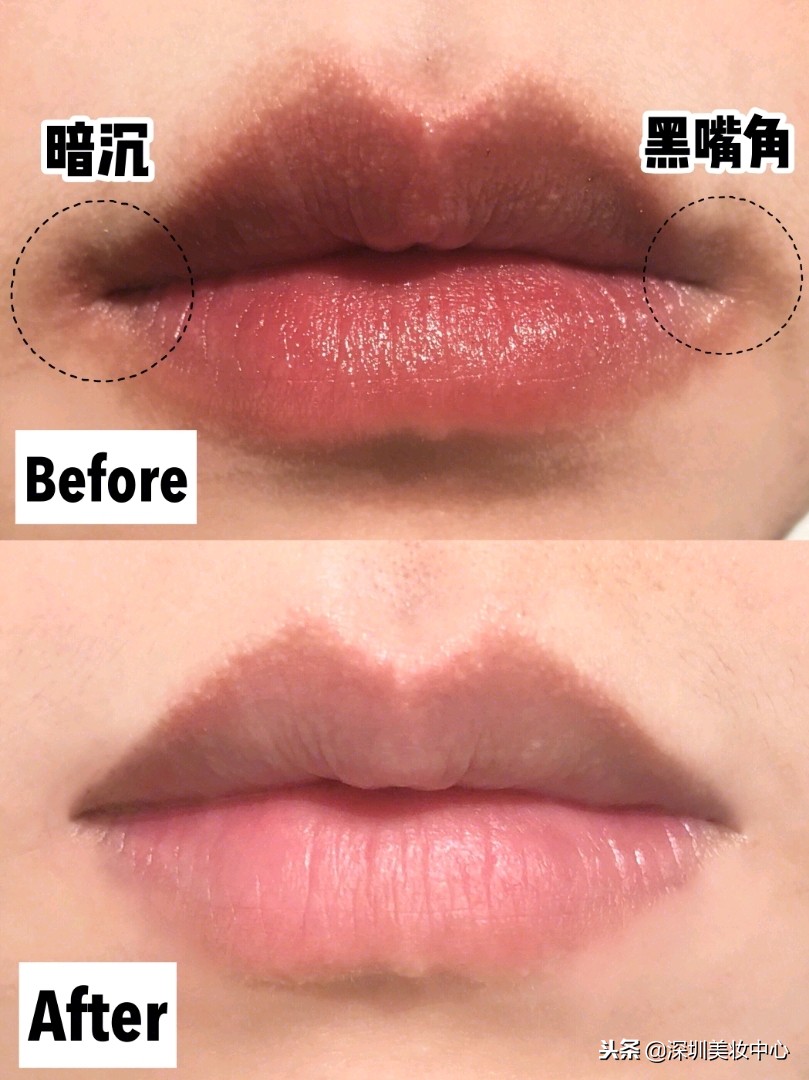 种草：嘴角、唇周围发黑，变白有招，温和不伤肤！