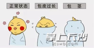 家长注意：夏天，要不要给孩子的小丁丁脱下“厚外套”？