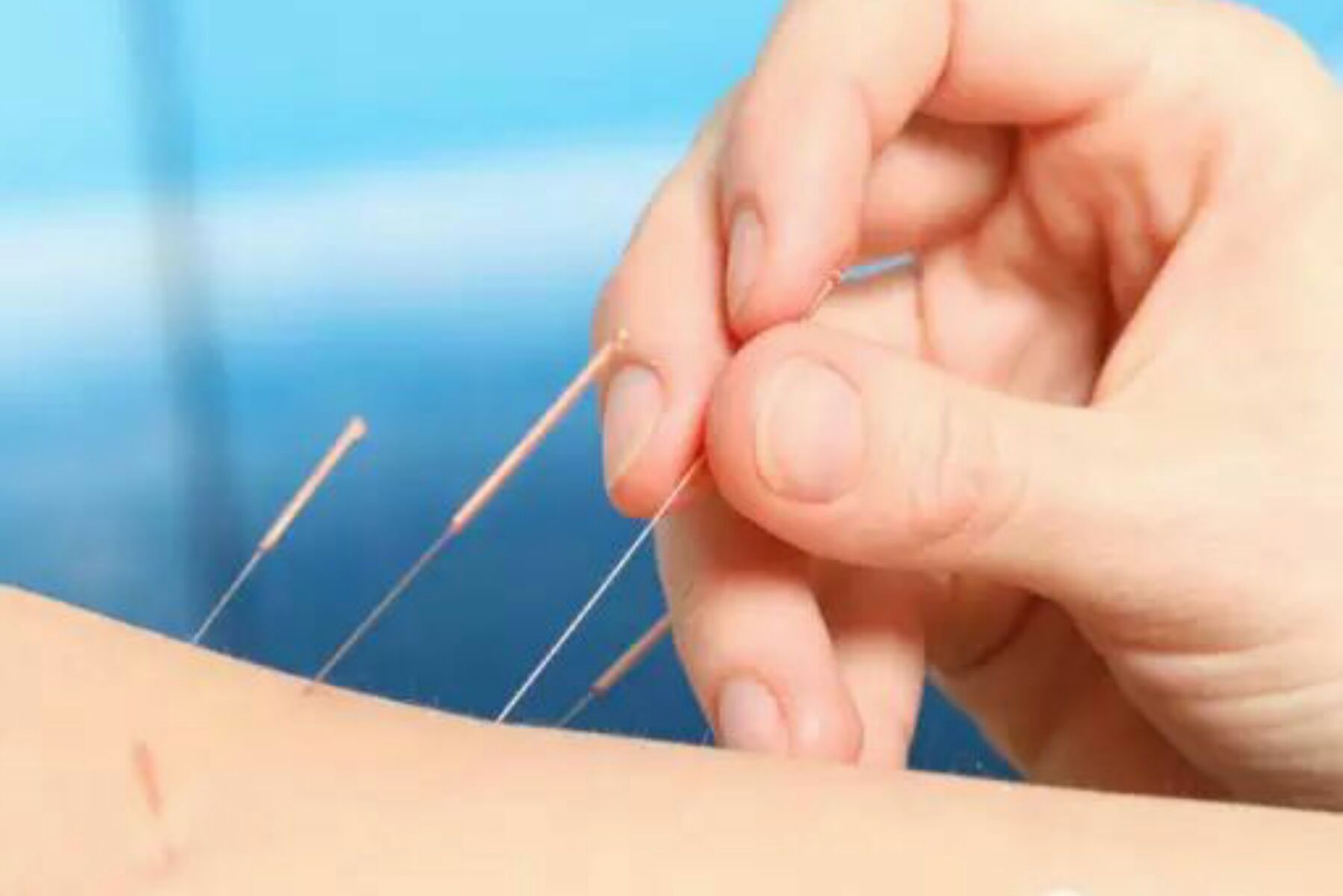 中医推拿治疗妇科疾病视频,妇科疾病推拿治疗