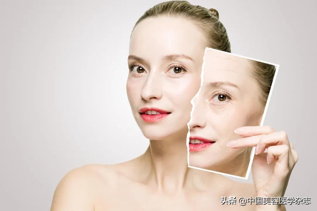 氩激光治疗皮肤有副作用吗,激光可以治疗哪些皮肤问题