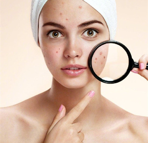 身上肉球hpv,身上长包怎么检查hpv