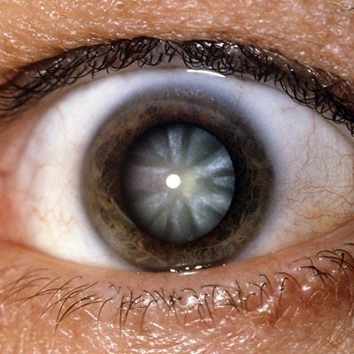 中年人需预防的疾病,中老年人预防眼睛疾病的最佳方法