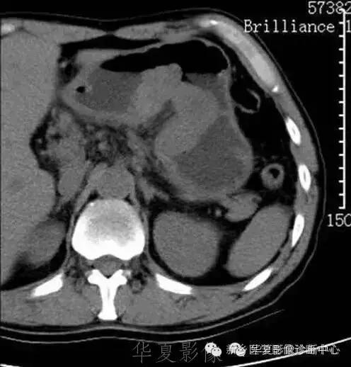 这些部位的黑色素瘤，您会诊断吗？