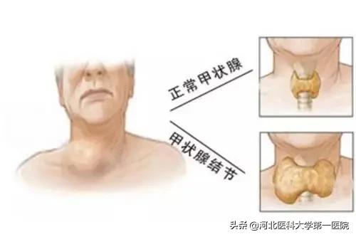 针尖对麦芒有道理吗,针尖对麦芒终究是对头