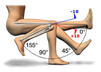 膝盖疼但想练腿怎么办,膝盖疼是锻炼好还是不锻炼好