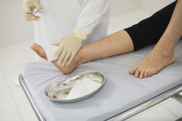 手术去除疤痕多少钱,疤痕手术能去除吗