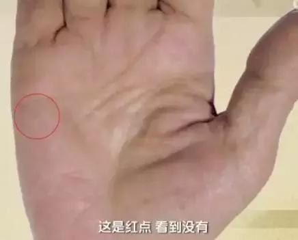 手诊10种常见病从手上就能看出来,如何辨别手掌的健康