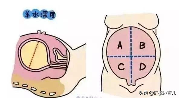 四维彩超四个数据判断胎儿发育,孕期四维彩超查些什么项目