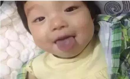 孩子发烧咳嗽腹胀便秘,宝宝积食发烧还咳嗽厉害