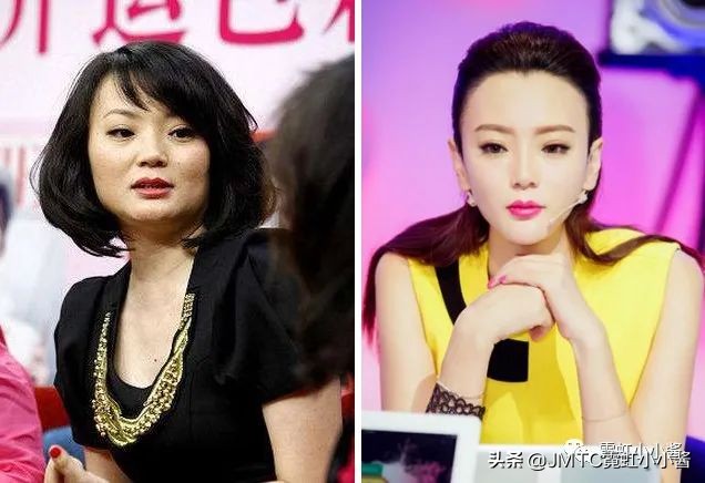 25岁抗老拯救垮脸,哪种脸型抗衰抗皱