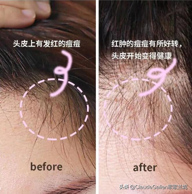 杨颖黄晓明发型,杨颖的头发换过几次