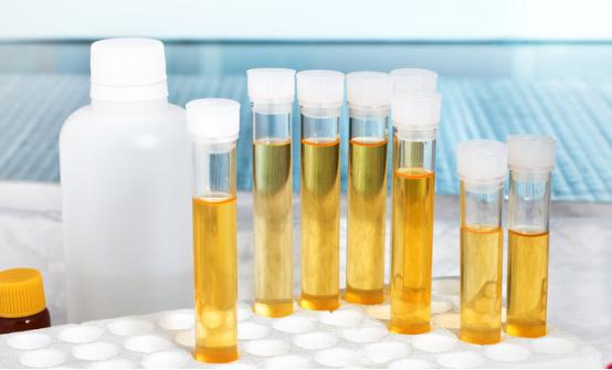 排尿黄异味很大是什么原因,排尿很黄还有分泌物怎么回事