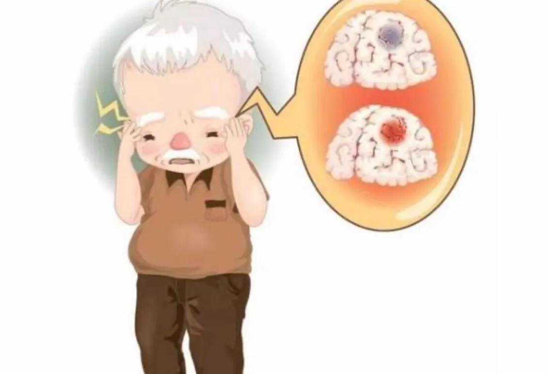 今日故事最新视频,今日头条有关脑梗的文章