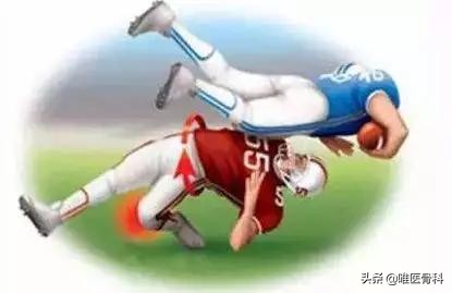 怎么判断交叉韧带损伤,膝关节交叉韧带损伤专家