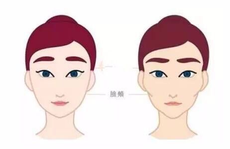 脸颊胶原蛋白补充,脸颊凹陷胶原蛋白流失如何补过来