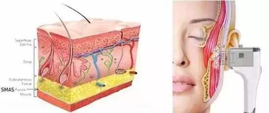 赵露思推荐好物清洁面部,赵露思推荐脸部小熨斗