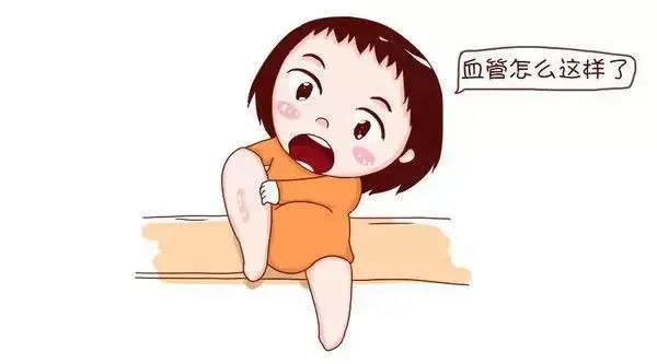 皮肤上的青筋,最近血管青筋比较明显