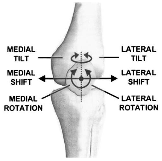 q角评估,q角指标详解图解