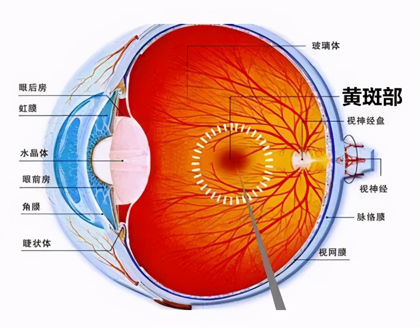 视神经萎缩老中医偏方,视神经萎缩视野缺失是什么症状