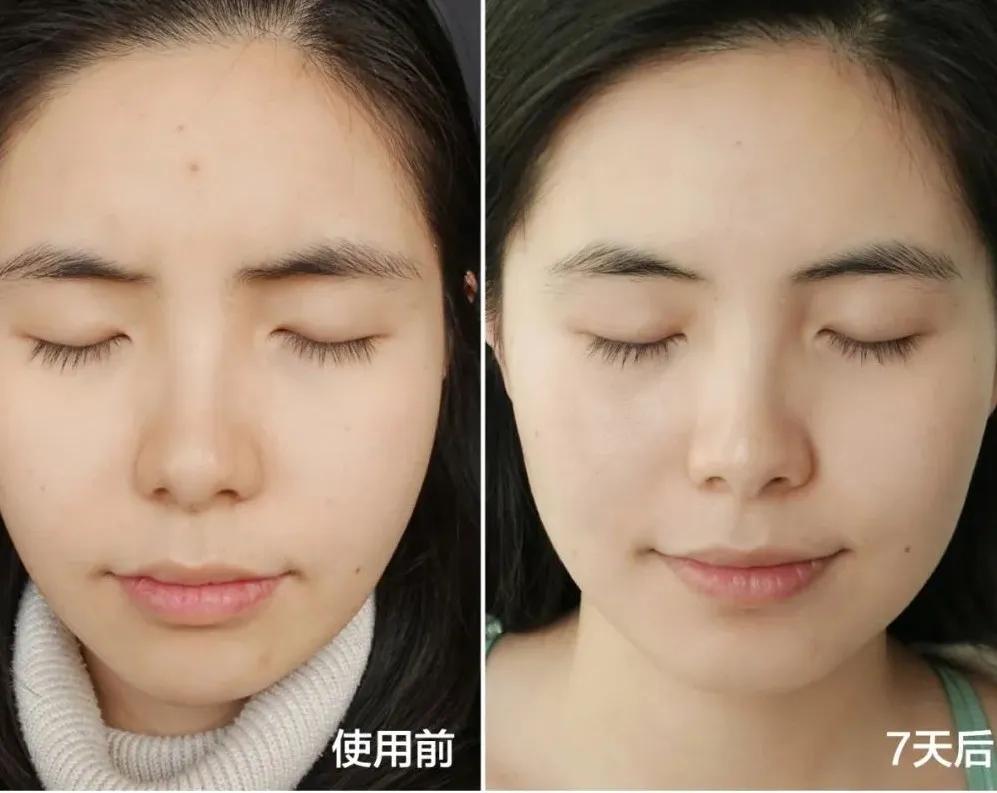 面容憔悴脸颊凹陷,怎么拯救我的老脸