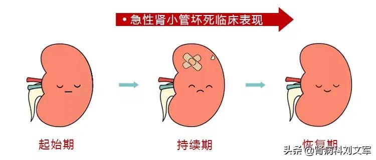 急性肾功能损伤用药指导,药物肾损伤注意什么饮食