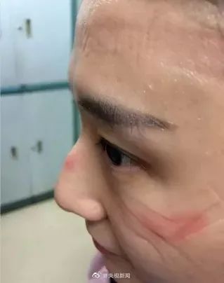 抗击疫情贵州支援恩施,抗击疫情贵州在行动