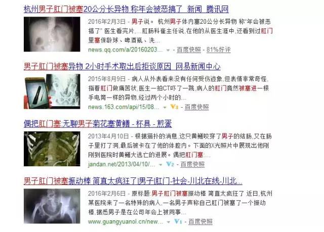 肛门塞异物很刺激？医生忙说：别乱来，快感之后全是悲伤