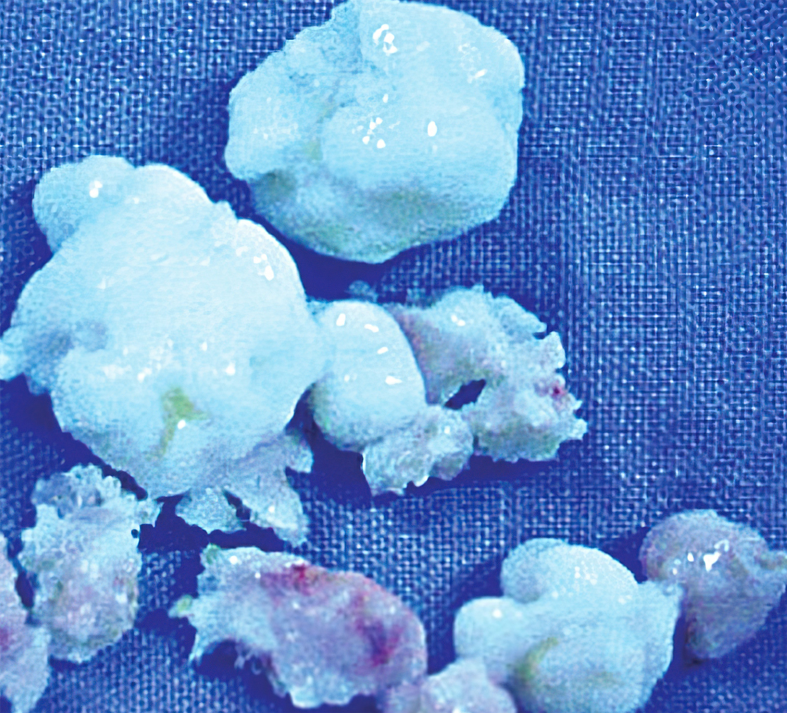 膝关节骨关节炎怎样手术能治好,膝关节镜能治好关节炎吗