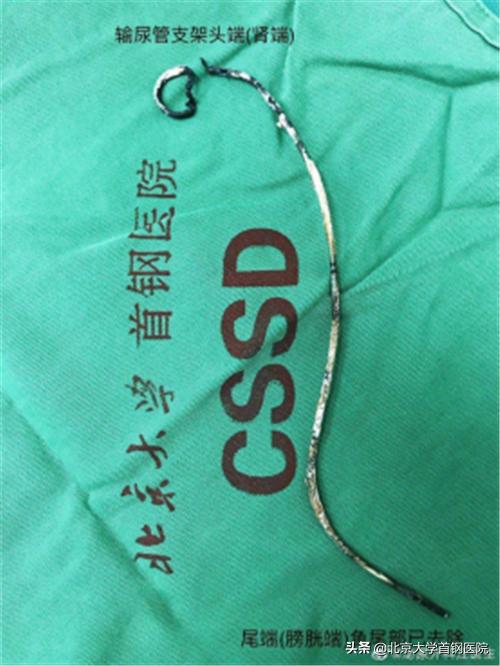 疯狂的石头泌尿外科,疯狂的石头北京