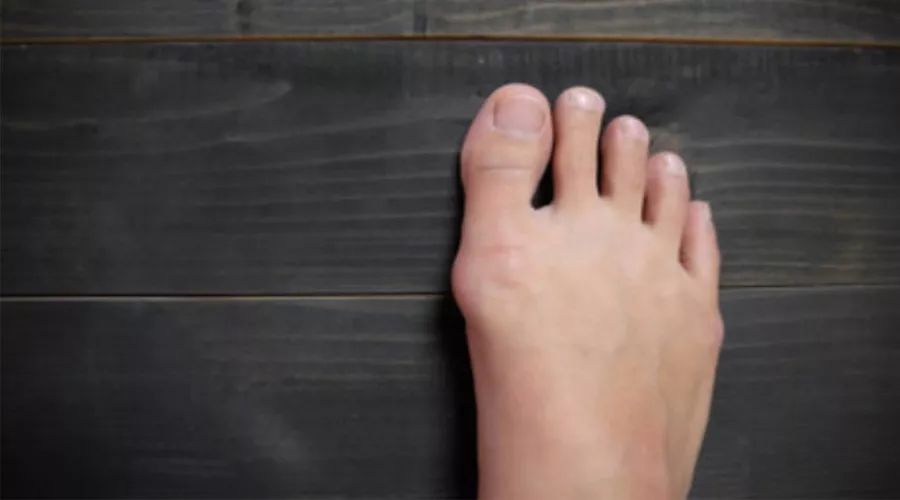 权健事件丁香园天价鞋垫被曝光,丁香园权健文章