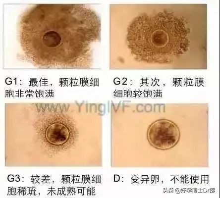 怎样的卵子是优质卵子,什么样的卵子最好的