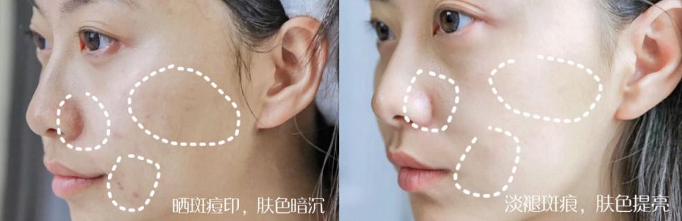 韩束新品升级在哪里,韩束亮肤型