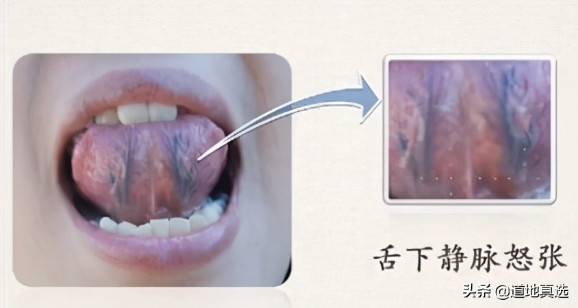 珍贵的舌诊图谱，看舌头知健康，人手一份！你也能快速识别疾病