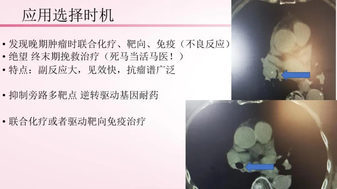 抗血管生成靶向药能把癌症治愈吗,晚期患者靶向和免疫治疗