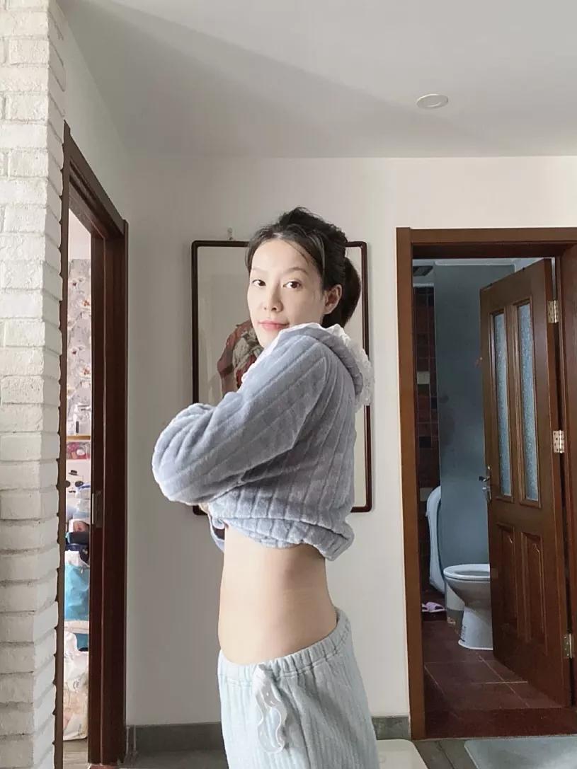 孕期长胎不长肉是不是不长妊娠纹,孕期长胎不长肉运动视频