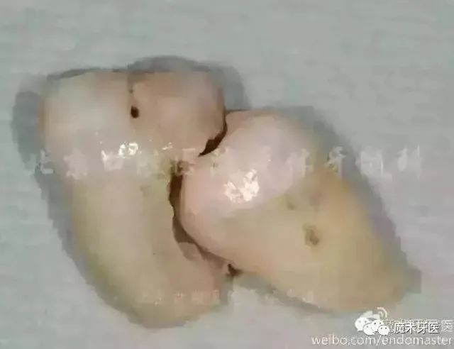 美国警察跪杀案宣判,美国警察跪杀案例