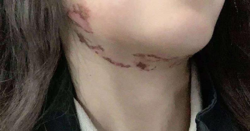 夏天碰到这种小虫子要警惕,这些常见又危险的小虫子