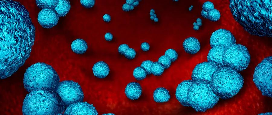 不想肿瘤复发,不想癌症复发的最好方法