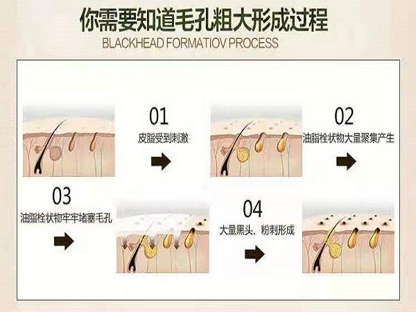 去黑头收缩毛孔最快最有效的方法,去黑头收缩毛孔的最简单方法