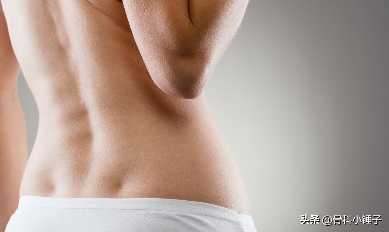 腰间盘突出压迫神经腿疼该怎么办,腰椎间盘突出压迫神经腿疼锻炼操