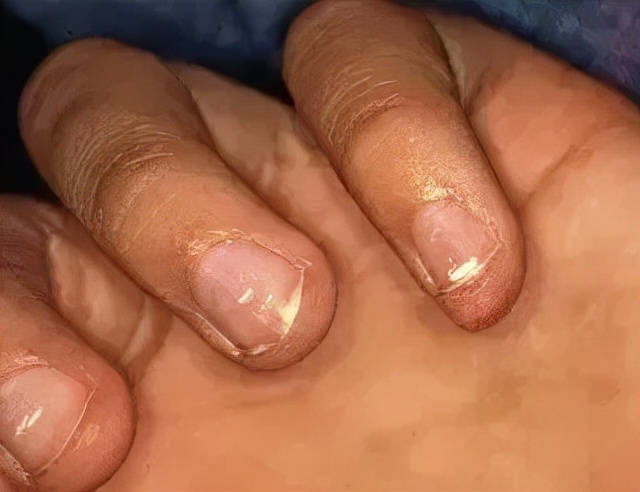 想让指甲长得快些怎么办,想让指甲变好看怎么办