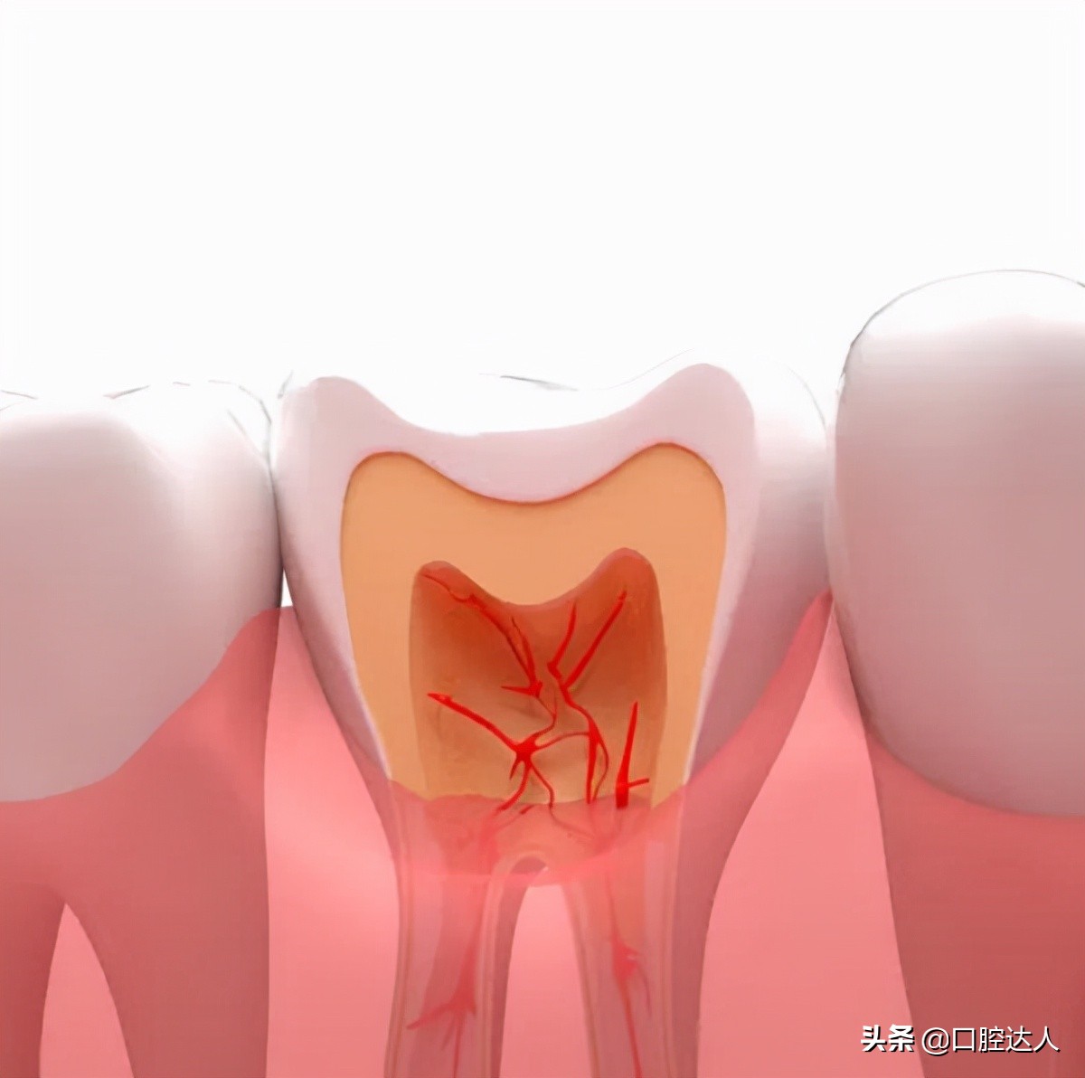 牙疼睡不着怎么缓解快速入睡,怀孕牙疼的晚上睡不着怎么缓解
