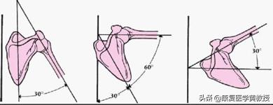 黄教授讲脑梗,中风后遗症肩痛的康复治疗